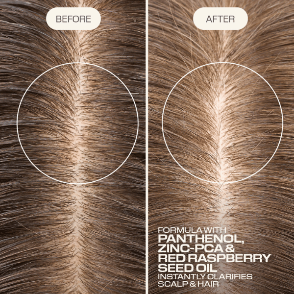 kopfhaut-vorher-und-nachher-mit-panthenol-zink-pca-und-himbeersamenoel-im-goldwell-dualsenses-scalp-specialist-clarifying-shampoo