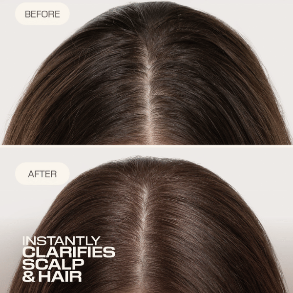 kopfhaut-vorher-und-nachher-der-reinigung-mit-goldwell-dualsenses-scalp-specialist-clarifying-shampoo